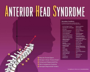 Anterior Head Syndrome